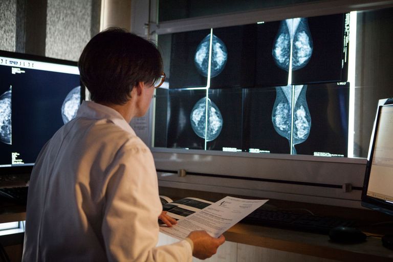 radiology-center-france-radiologist-looks-at-the-results-of-news-photo-1578078596.jpg