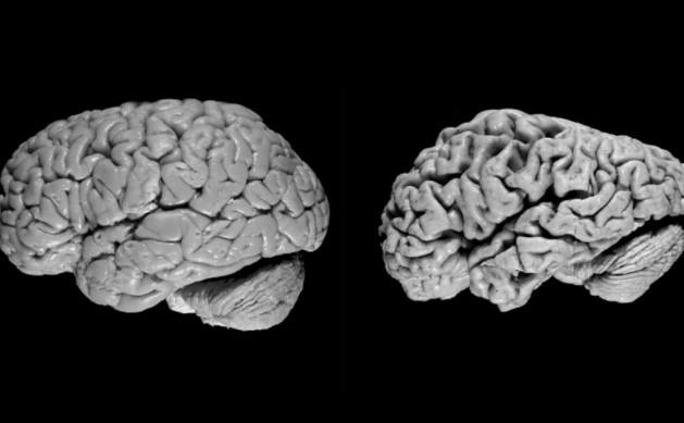 مغز 2.jpg