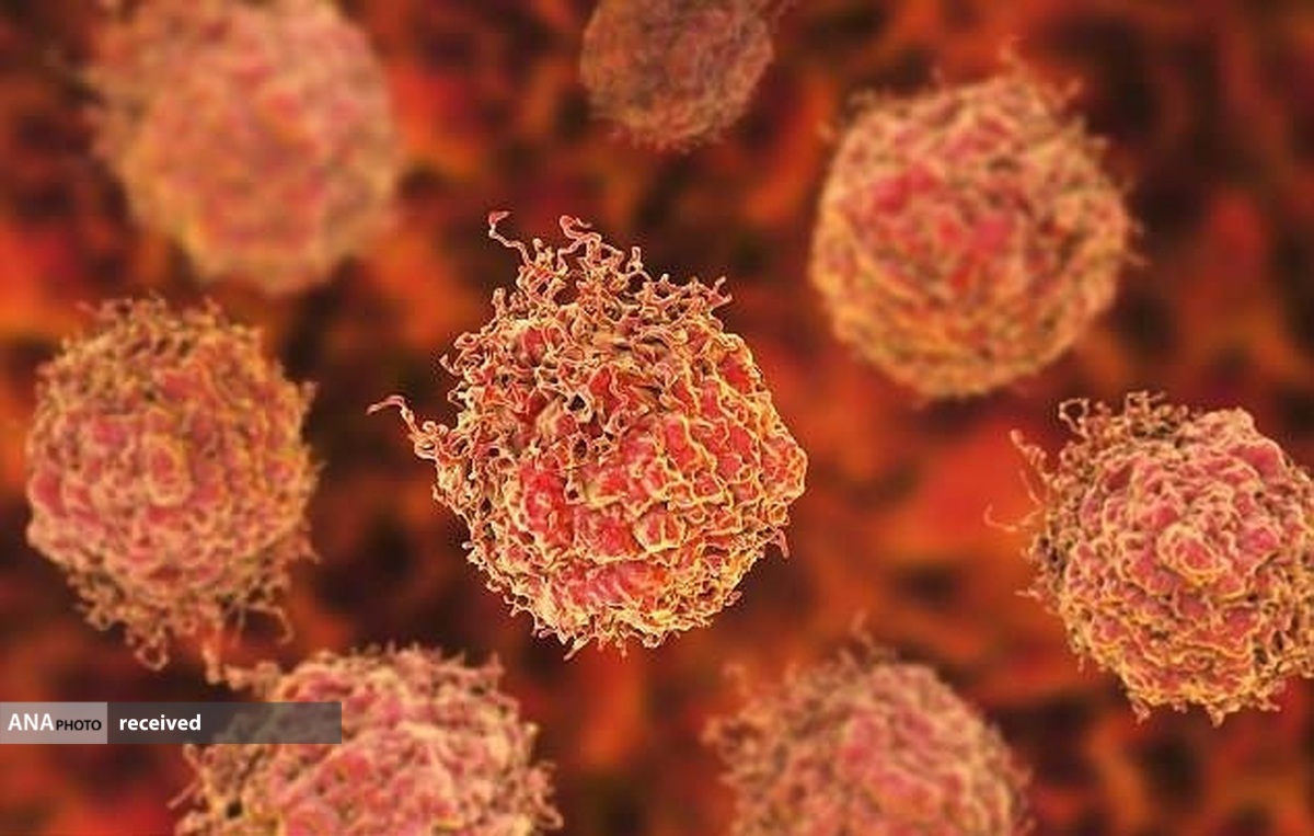 کشف یک آزمایش خون سریع و ارزان برای تشخیص سرطان پروستات
