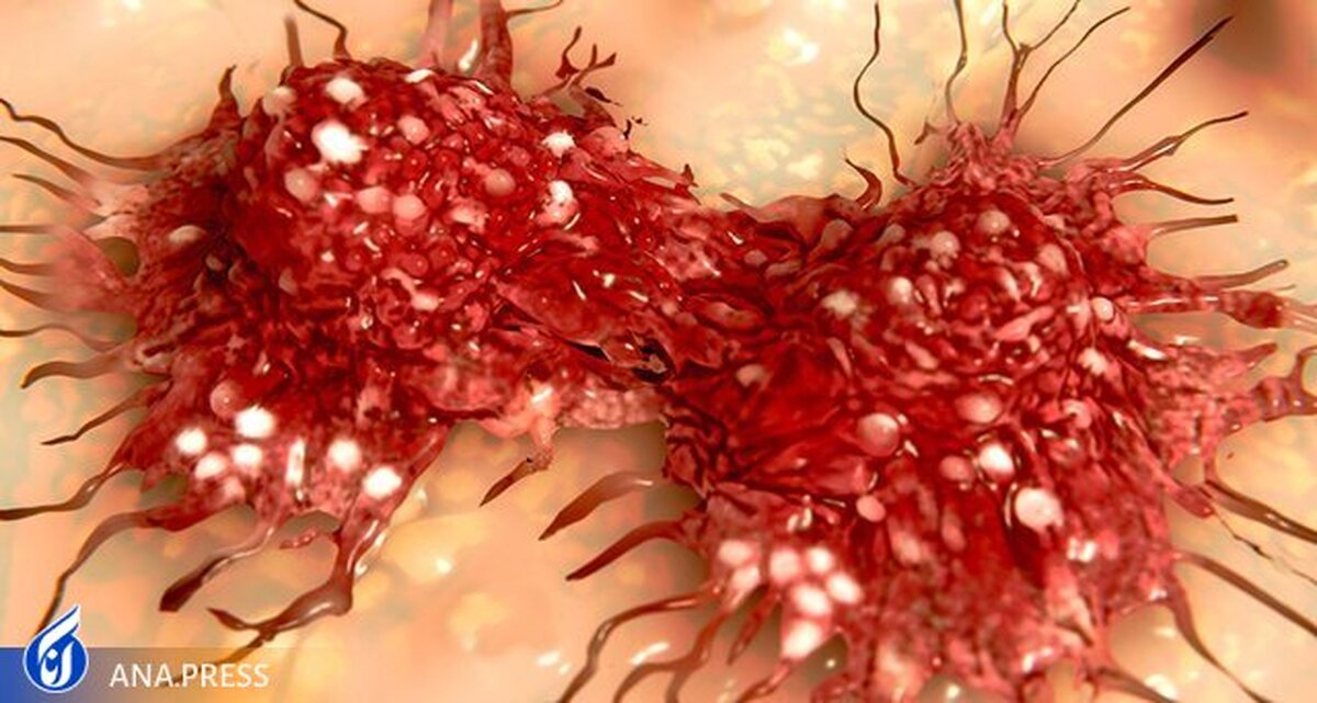 مهار سلول‌های سرطانی مقاوم به دارو ممکن شد