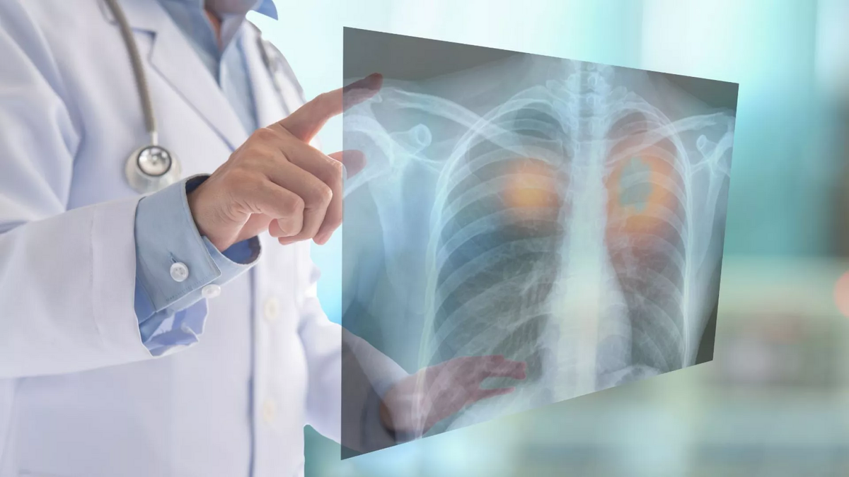 چگونه می‌توان سرطان ریه را درمان کرد
