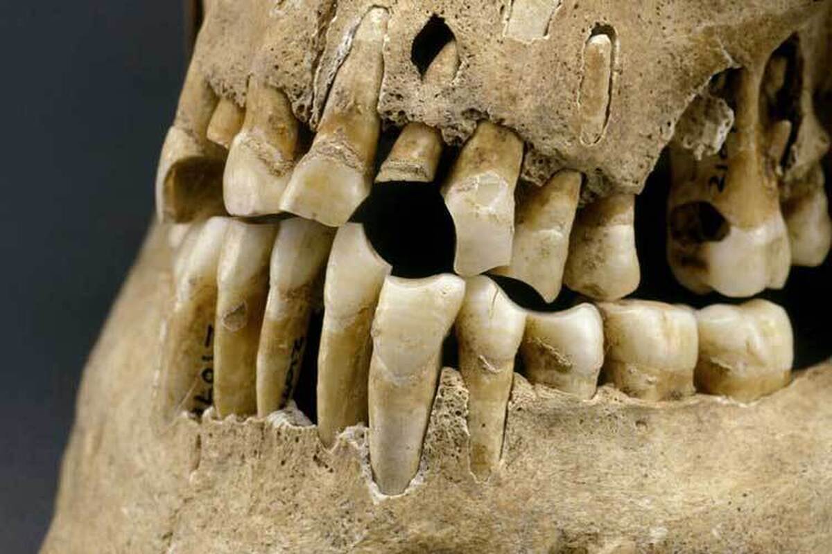 فسیل‌های یافت‌شده در مصر الگو‌های شکستگی و پوسیدگی دندان را فاش کردند