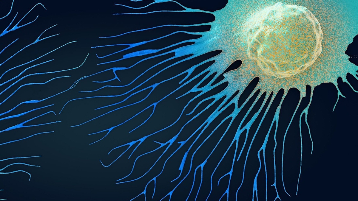 سلول‌های سرطانی زیر تیغ «آلیاژ نانویی»