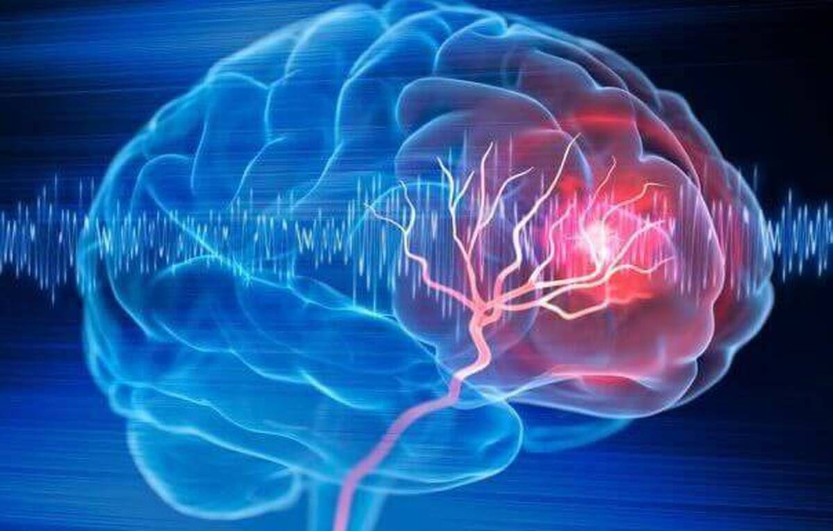 درمان آسیب‌های مغزی به کمک سلول‌های بنیادی و چاپگر سه بعدی