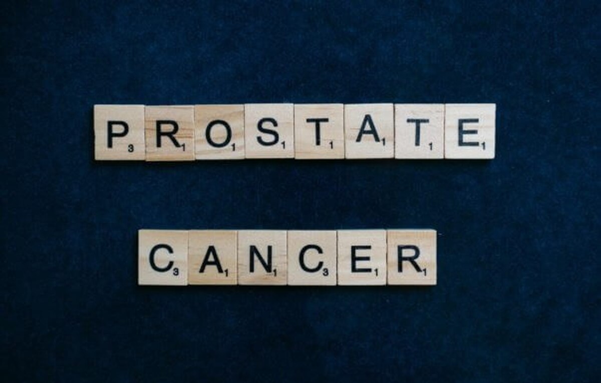 کشف دو راهکار جدید برای درمان سرطان پروستات بدخیم