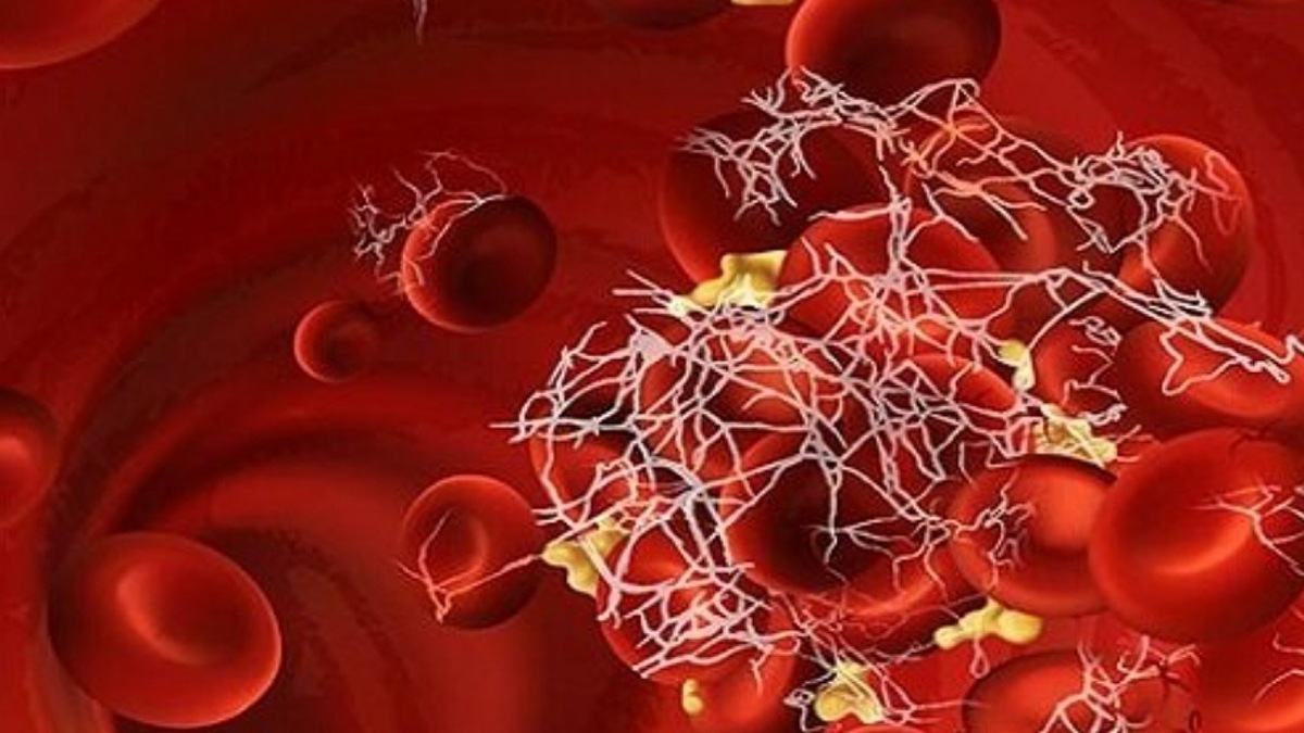 تامین ۷۰ درصد فاکتور ۸ خونی از طریق تولید داخل